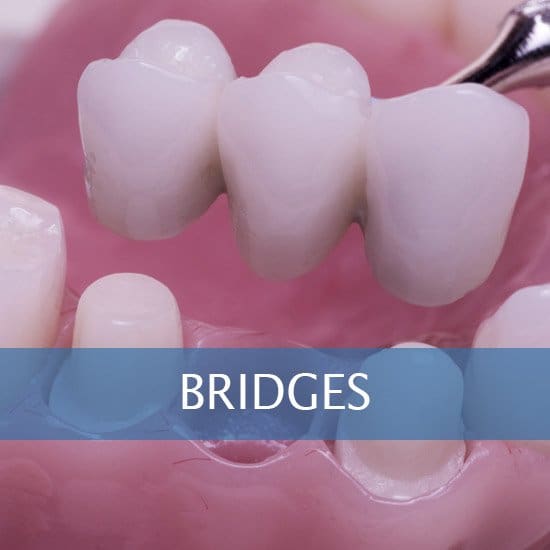 Bridges - Crowns - Dental Hygene - Teeth Whitening - Veneers - Dental Implants - Dentures - Exractions - Root Canals, Crown Lenghtening - Post Op Instructions - Framingham Dentists, Unique Dental of Framingham.