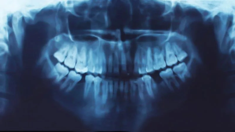 Close-up view of oral teeth x-rays of a patient.
