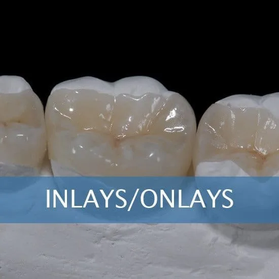 Inlays and onlays services at Unique Dental of Framingham.